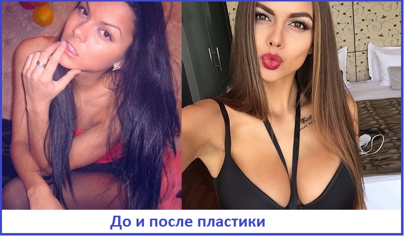 одинцова до пластических изменений