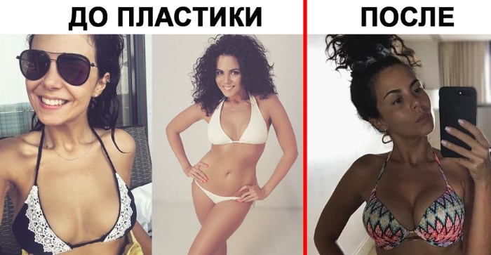 Настя Каменских. Фото в купальнике, без макияжа, до пластики и после, личная жизнь